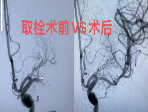 一向体健的韩大爷正和老伴坐在炕上边聊天边看电视,突然不省人事了......休闲区蓝鸢梦想 - Www.slyday.coM 一向体健的韩大爷正和老伴坐在炕上边聊天边看电视,突然不省人事了......休闲区蓝鸢梦想 - Www.slyday.coM