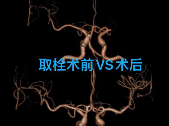一向体健的韩大爷正和老伴坐在炕上边聊天边看电视,突然不省人事了......休闲区蓝鸢梦想 - Www.slyday.coM 一向体健的韩大爷正和老伴坐在炕上边聊天边看电视,突然不省人事了......休闲区蓝鸢梦想 - Www.slyday.coM