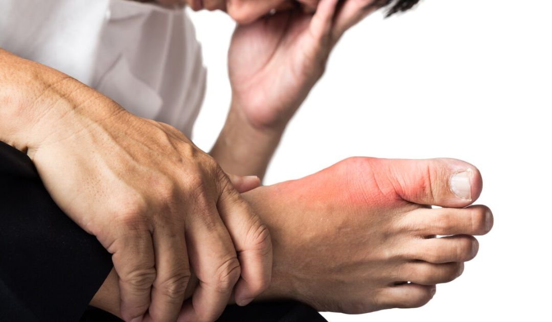 体检发现尿酸高,就是痛风?注意!这些因素可能会影响尿酸的检测结果休闲区蓝鸢梦想 - Www.slyday.coM 体检发现尿酸高,就是痛风?注意!这些因素可能会影响尿酸的检测结果休闲区蓝鸢梦想 - Www.slyday.coM