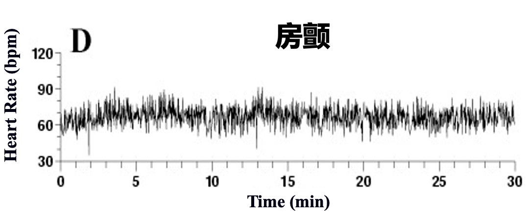 很多人对健康的理解,其实是错误的休闲区蓝鸢梦想 - Www.slyday.coM 很多人对健康的理解,其实是错误的休闲区蓝鸢梦想 - Www.slyday.coM