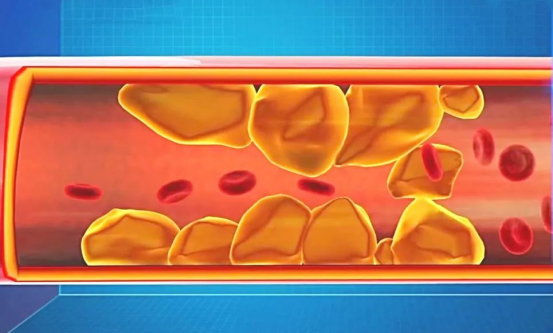 不吃早饭VS不吃晚饭,哪个更危险?这些研究告诉你答案休闲区蓝鸢梦想 - Www.slyday.coM 不吃早饭VS不吃晚饭,哪个更危险?这些研究告诉你答案休闲区蓝鸢梦想 - Www.slyday.coM
