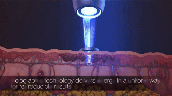 济南海峡整形分享:很多女孩都喜欢的超皮秒淡斑到底怎样?休闲区蓝鸢梦想 - Www.slyday.coM 济南海峡整形分享:很多女孩都喜欢的超皮秒淡斑到底怎样?休闲区蓝鸢梦想 - Www.slyday.coM