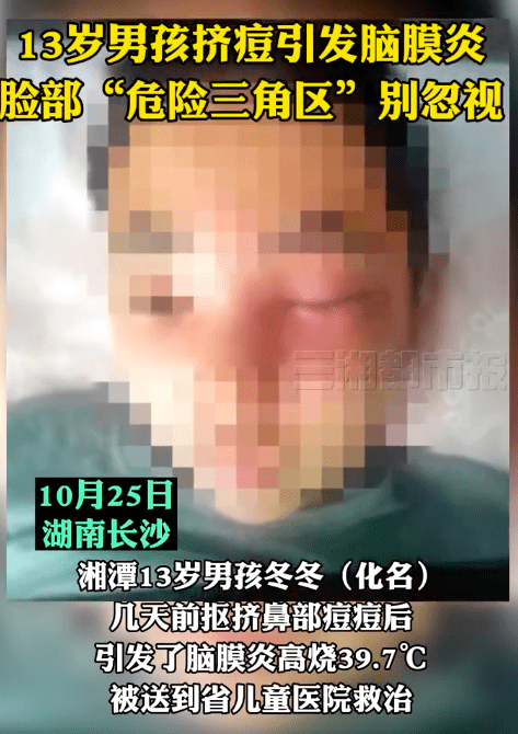 悲剧了!男孩挤痘引发脑膜炎,“危险三角区”到底有多危险?休闲区蓝鸢梦想 - Www.slyday.coM 悲剧了!男孩挤痘引发脑膜炎,“危险三角区”到底有多危险?休闲区蓝鸢梦想 - Www.slyday.coM