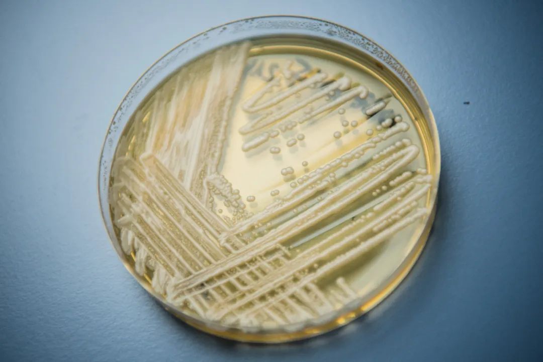 资料图：培养皿中的“超级真菌”。图/IC photo