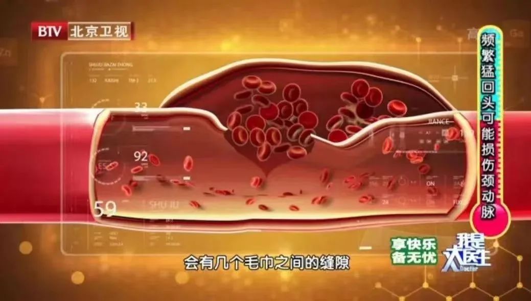 22岁女子按摩后大面积脑梗!这3个不经意的习惯或是“背后推手”!补充3种营养,帮你护血管休闲区蓝鸢梦想 - Www.slyday.coM 22岁女子按摩后大面积脑梗!这3个不经意的习惯或是“背后推手”!补充3种营养,帮你护血管休闲区蓝鸢梦想 - Www.slyday.coM