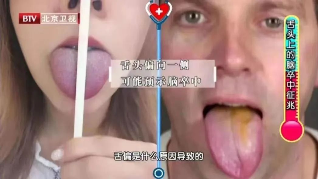 22岁女子按摩后大面积脑梗!这3个不经意的习惯或是“背后推手”!补充3种营养,帮你护血管休闲区蓝鸢梦想 - Www.slyday.coM 22岁女子按摩后大面积脑梗!这3个不经意的习惯或是“背后推手”!补充3种营养,帮你护血管休闲区蓝鸢梦想 - Www.slyday.coM
