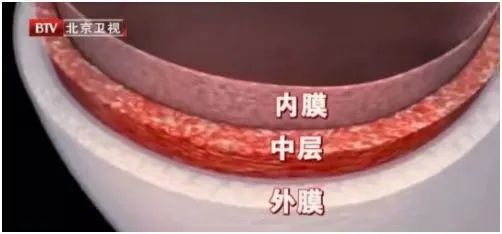 22岁女子按摩后大面积脑梗!这3个不经意的习惯或是“背后推手”!补充3种营养,帮你护血管休闲区蓝鸢梦想 - Www.slyday.coM 22岁女子按摩后大面积脑梗!这3个不经意的习惯或是“背后推手”!补充3种营养,帮你护血管休闲区蓝鸢梦想 - Www.slyday.coM