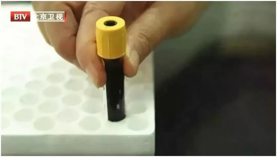 又是“吃出来的疾病”!一次发炎就可能“要命”,比癌症更危急!最近又有人中招了休闲区蓝鸢梦想 - Www.slyday.coM 又是“吃出来的疾病”!一次发炎就可能“要命”,比癌症更危急!最近又有人中招了休闲区蓝鸢梦想 - Www.slyday.coM