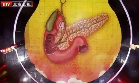 又是“吃出来的疾病”!一次发炎就可能“要命”,比癌症更危急!最近又有人中招了休闲区蓝鸢梦想 - Www.slyday.coM 又是“吃出来的疾病”!一次发炎就可能“要命”,比癌症更危急!最近又有人中招了休闲区蓝鸢梦想 - Www.slyday.coM