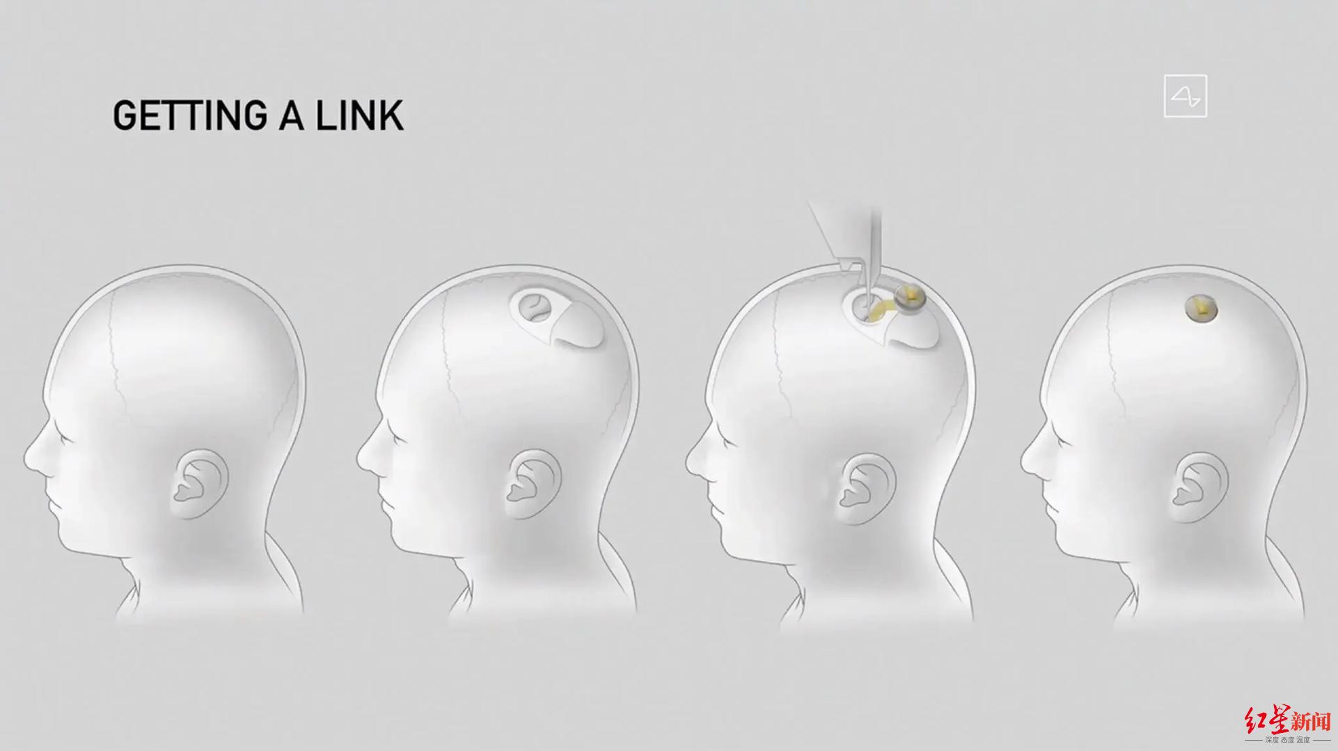 基于EEG的脑机接口的技术和应用-轻识