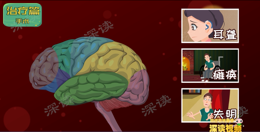 癫痫治疗长期用药不说,还容易复发,该怎么办?趣味解读癫痫治疗休闲区蓝鸢梦想 - Www.slyday.coM 癫痫治疗长期用药不说,还容易复发,该怎么办?趣味解读癫痫治疗休闲区蓝鸢梦想 - Www.slyday.coM