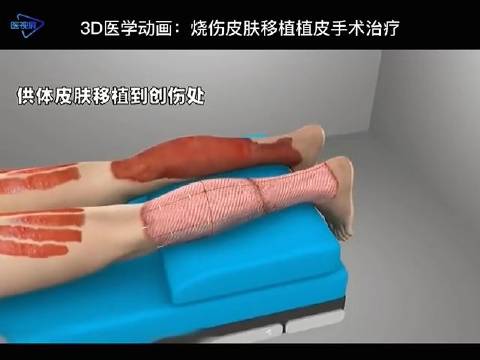 心理学与医学相学在人格分裂中的应用