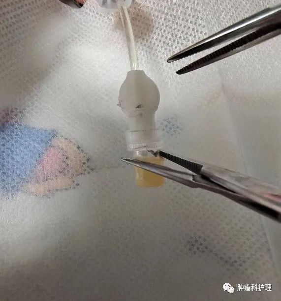 速看(picc管肝素帽)picc连接肝素帽,患儿肝素帽和PICC旋的过紧、拧不开时,你是怎么办的?, 速看(picc管肝素帽)picc连接肝素帽,患儿肝素帽和PICC旋的过紧、拧不开时,你是怎么办的?,