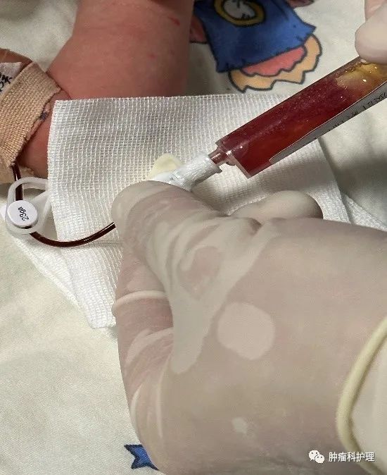 速看(picc管肝素帽)picc连接肝素帽,患儿肝素帽和PICC旋的过紧、拧不开时,你是怎么办的?, 速看(picc管肝素帽)picc连接肝素帽,患儿肝素帽和PICC旋的过紧、拧不开时,你是怎么办的?,