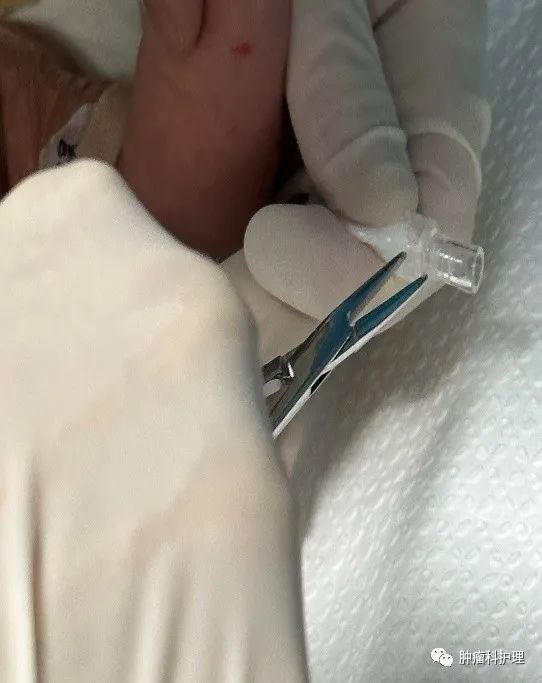 速看(picc管肝素帽)picc连接肝素帽,患儿肝素帽和PICC旋的过紧、拧不开时,你是怎么办的?, 速看(picc管肝素帽)picc连接肝素帽,患儿肝素帽和PICC旋的过紧、拧不开时,你是怎么办的?,