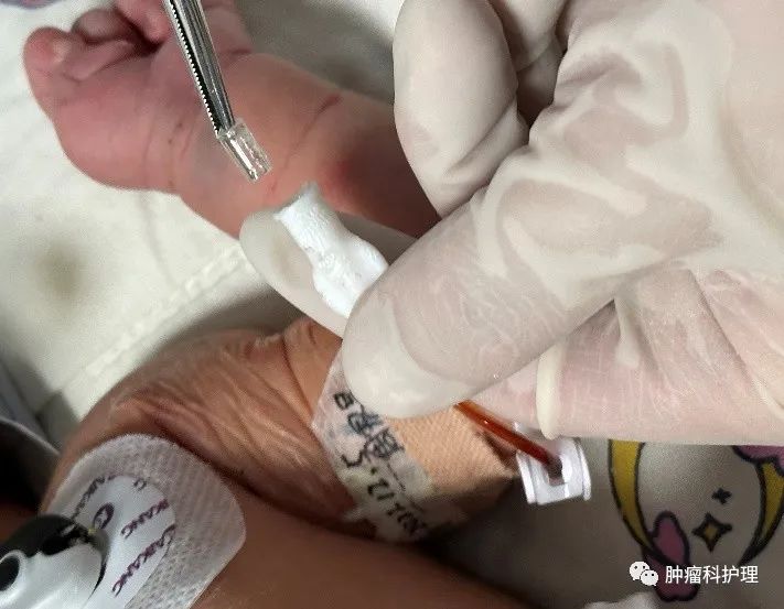 速看(picc管肝素帽)picc连接肝素帽,患儿肝素帽和PICC旋的过紧、拧不开时,你是怎么办的?, 速看(picc管肝素帽)picc连接肝素帽,患儿肝素帽和PICC旋的过紧、拧不开时,你是怎么办的?,