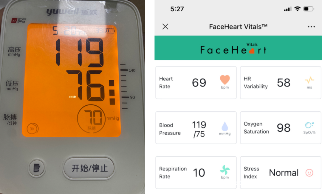 这都可以?(手机血氧检测什么意思)血氧检测仪检测,没有血氧仪?这个产品打开手机摄像头就能测, 这都可以?(手机血氧检测什么意思)血氧检测仪检测,没有血氧仪?这个产品打开手机摄像头就能测,