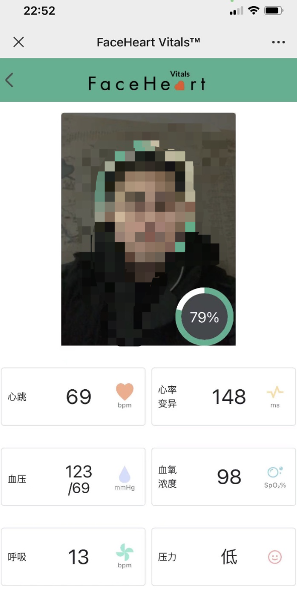 这都可以?(手机血氧检测什么意思)血氧检测仪检测,没有血氧仪?这个产品打开手机摄像头就能测, 这都可以?(手机血氧检测什么意思)血氧检测仪检测,没有血氧仪?这个产品打开手机摄像头就能测,