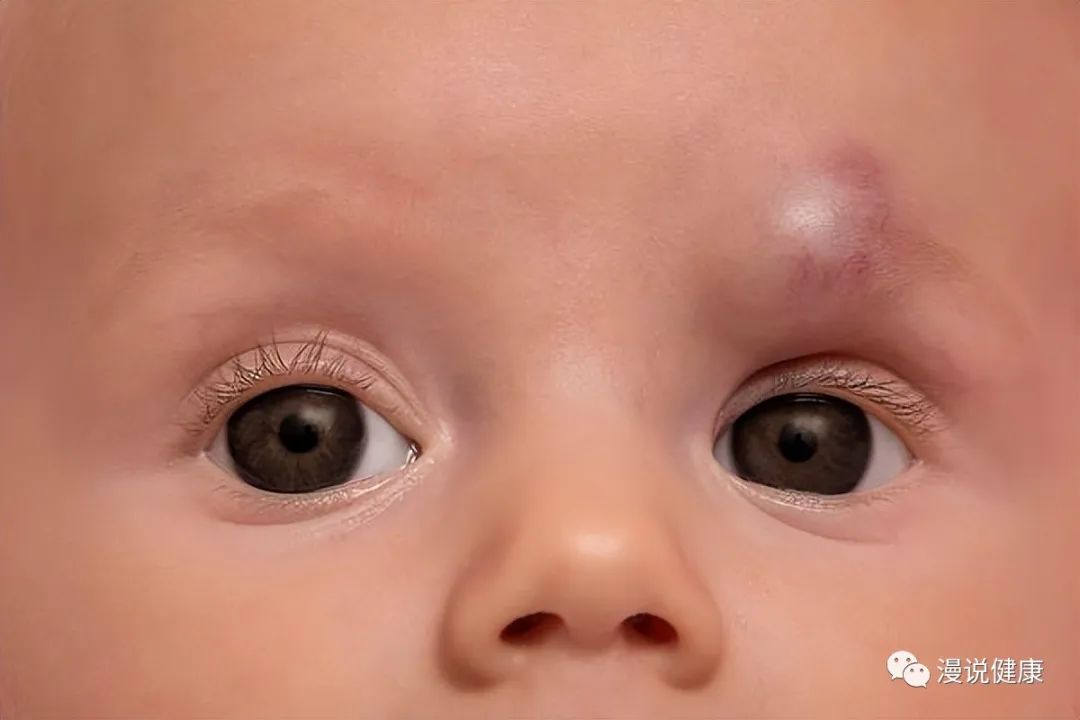 新冠病毒可能存在眼部趋向性?若孩子得了结膜炎,家长该如何处理休闲区蓝鸢梦想 - Www.slyday.coM 新冠病毒可能存在眼部趋向性?若孩子得了结膜炎,家长该如何处理休闲区蓝鸢梦想 - Www.slyday.coM