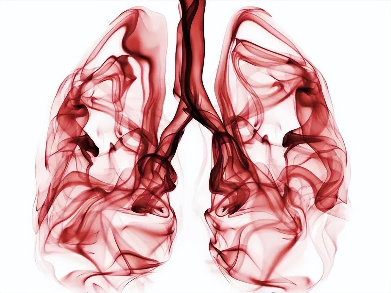 第三节 肺不张的CT基本表现-胸部CT-医学