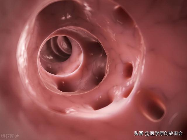 大便“前面干硬,后面软粘”,意味着什么?医生解密,又涨知识了