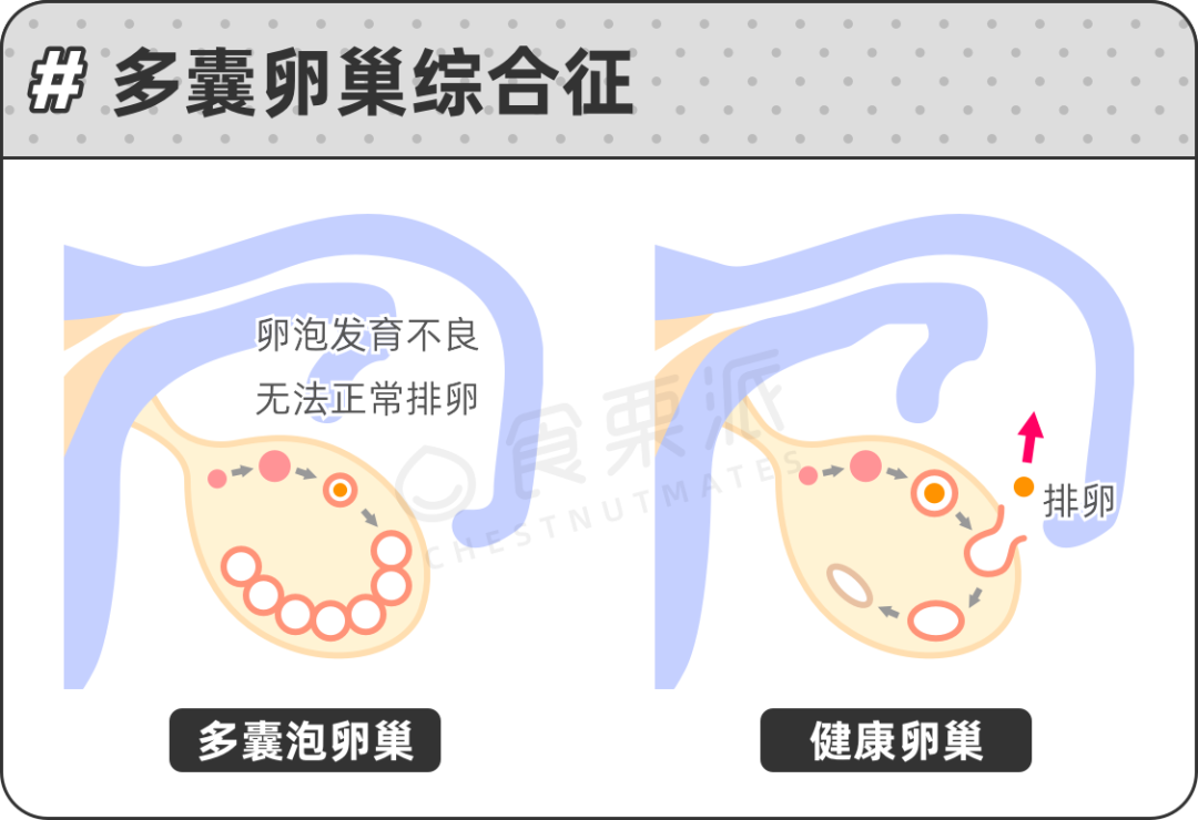 拉菲8平台-拉菲8注册-拉菲8登录(短信投注是真的吗)肌醇真的是多囊克星吗?,