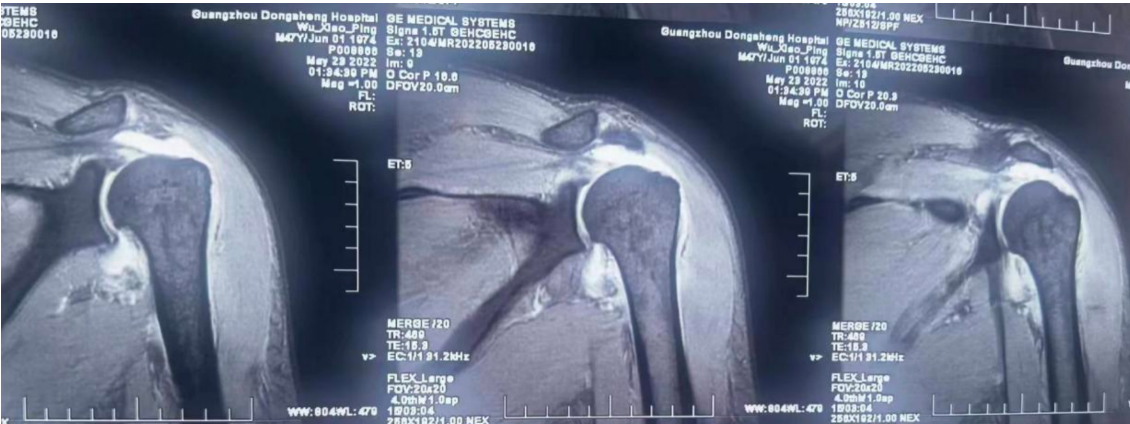 宇宙大撕裂时代即将到来，每一个原子都将被摧毁，人类...