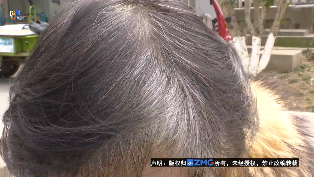 花4万多“白转黑”没效果 原理像“种菜”?1 花4万多“白转黑”没效果 原理像“种菜”?