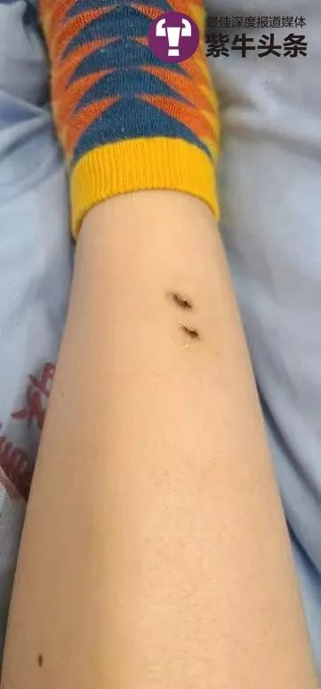 女子住酒店被毒蛇咬伤 酒店拒担全责,律师现场说法