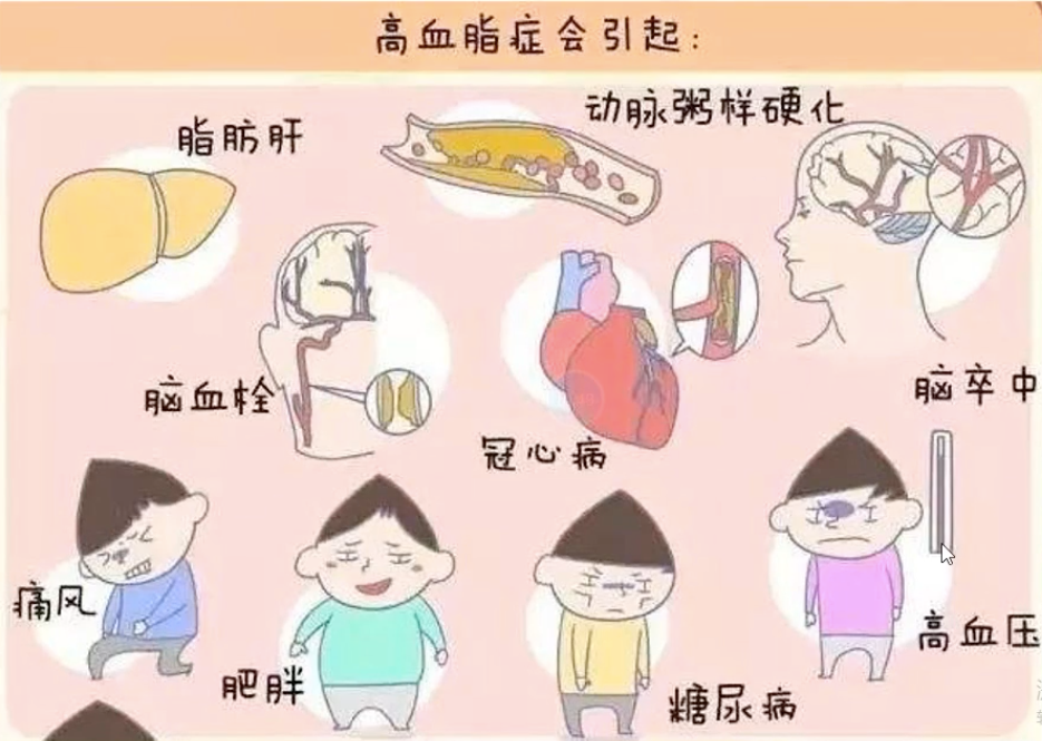 血脂异常后,9大危害如何处理?一文理清!