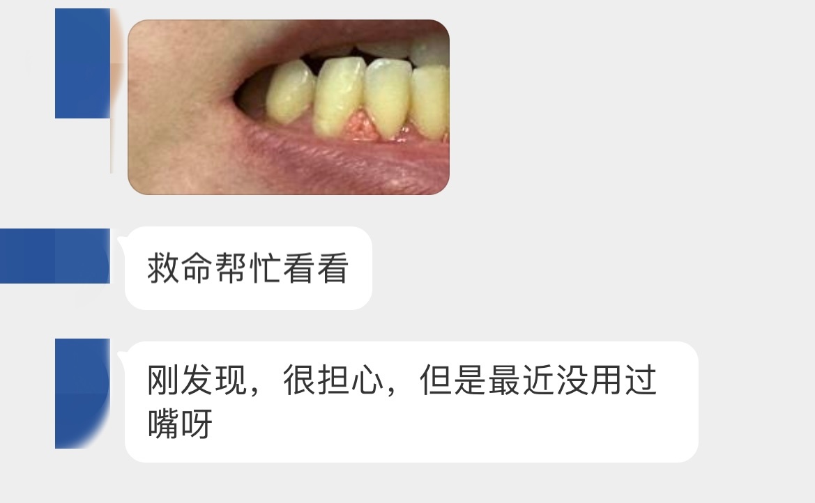 珠峰三轮摩托车后桥牙包里边是用哪种润滑油?