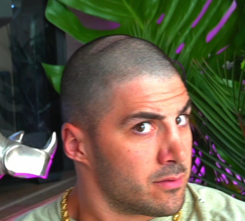 许多游戏玩家注意到由于长期戴耳机……游戏玩家耳机凹坑_新浪新闻