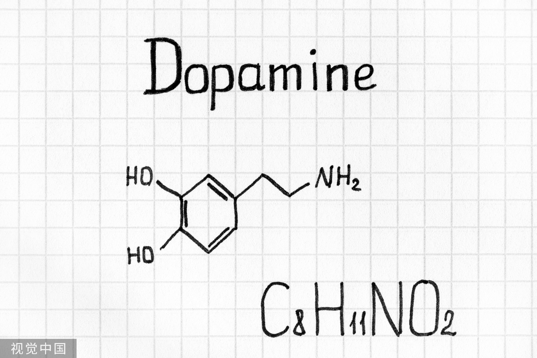 多巴胺和内啡肽带来的快乐 3334-1323e3e1b142f3a6976eb86a28c14e90.jpg