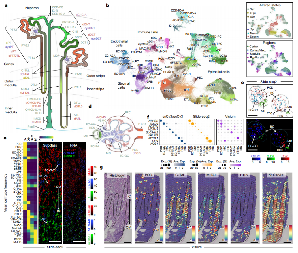 人类肾脏迎来“高清地图”：科学家建立迄今为止最大规模肾脏多维单细胞图谱，能预测患者五年之后的肾功能状况