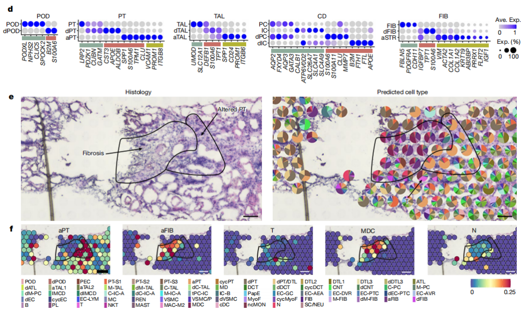 人类肾脏迎来“高清地图”：科学家建立迄今为止最大规模肾脏多维单细胞图谱，能预测患者五年之后的肾功能状况