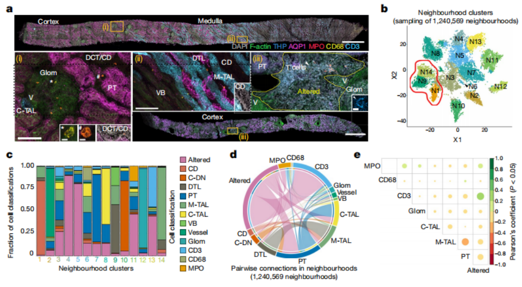 人类肾脏迎来“高清地图”：科学家建立迄今为止最大规模肾脏多维单细胞图谱，能预测患者五年之后的肾功能状况