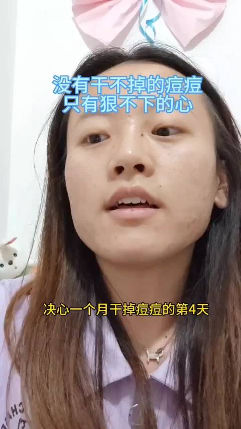 一个月逆袭，告别痘痘