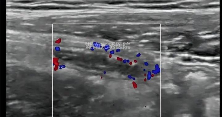 登月宇航员集体得怪病 月球尘埃竟是罪魁祸首