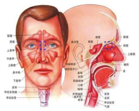 打鼾、耳鸣、嗅觉丧失？都是鼻息肉惹的“祸”