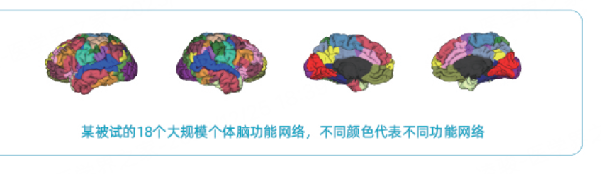 能让“哑巴”说话！中国科学家首次绘制个性化“大脑地图”