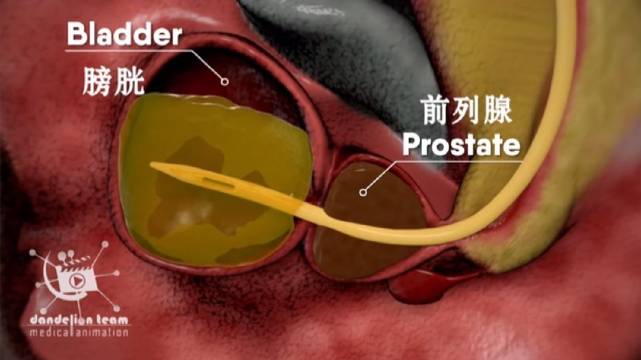 医疗诉讼举证责任倒置的三个条件及应对方法