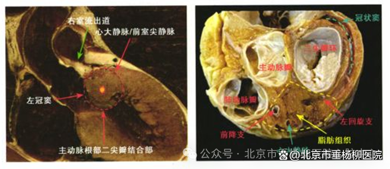 图3. 心脏summit区解剖结构