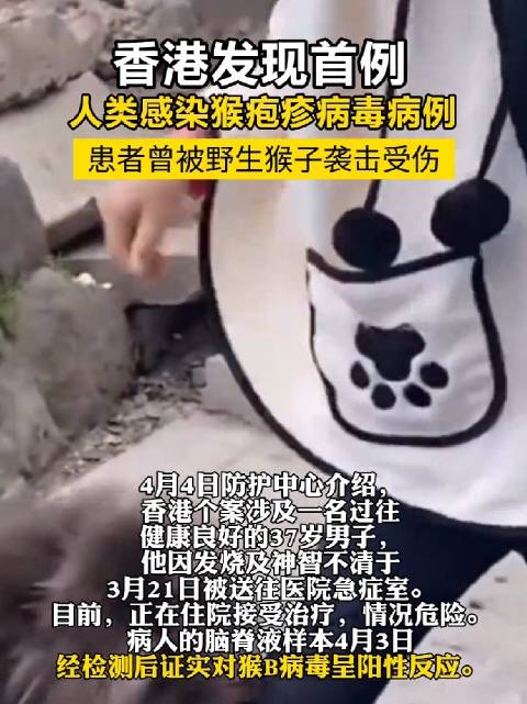 猴疱疹病毒来袭！香港首例病例曝光，原来是野生猴子搞的鬼！