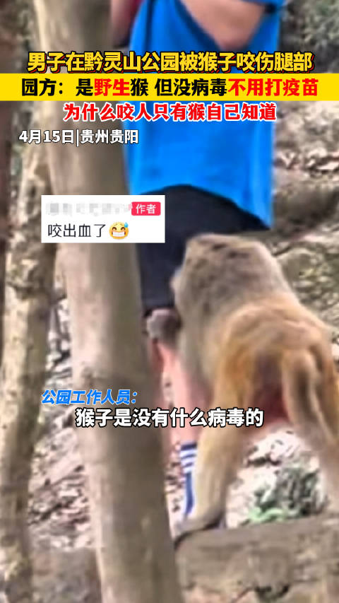 男子在黔灵山公园被猴子咬伤腿部 园方回应：是野生猴 但没病毒不用打疫苗