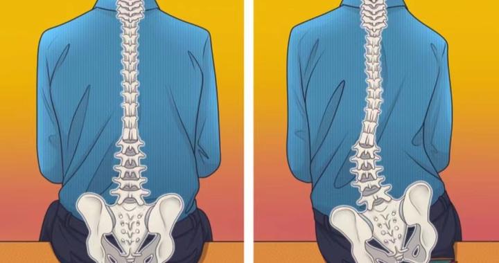 骨盆倾斜导致“脊柱侧弯”，一定要注意！（附瑜伽调理）