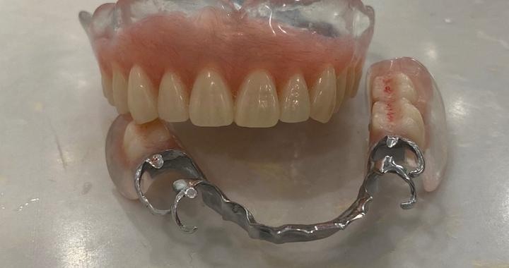 义齿与假牙有什么区别？