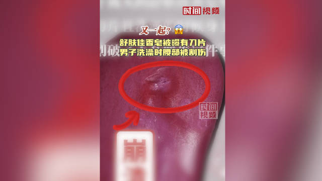 舒肤佳香皂被曝有刀片