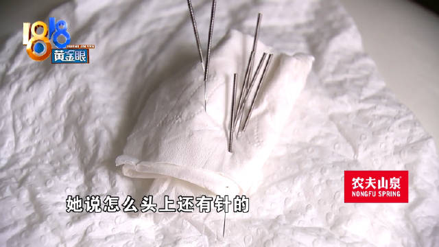 针灸医生忘拔患者头上七根针 回家吃饭才发现
