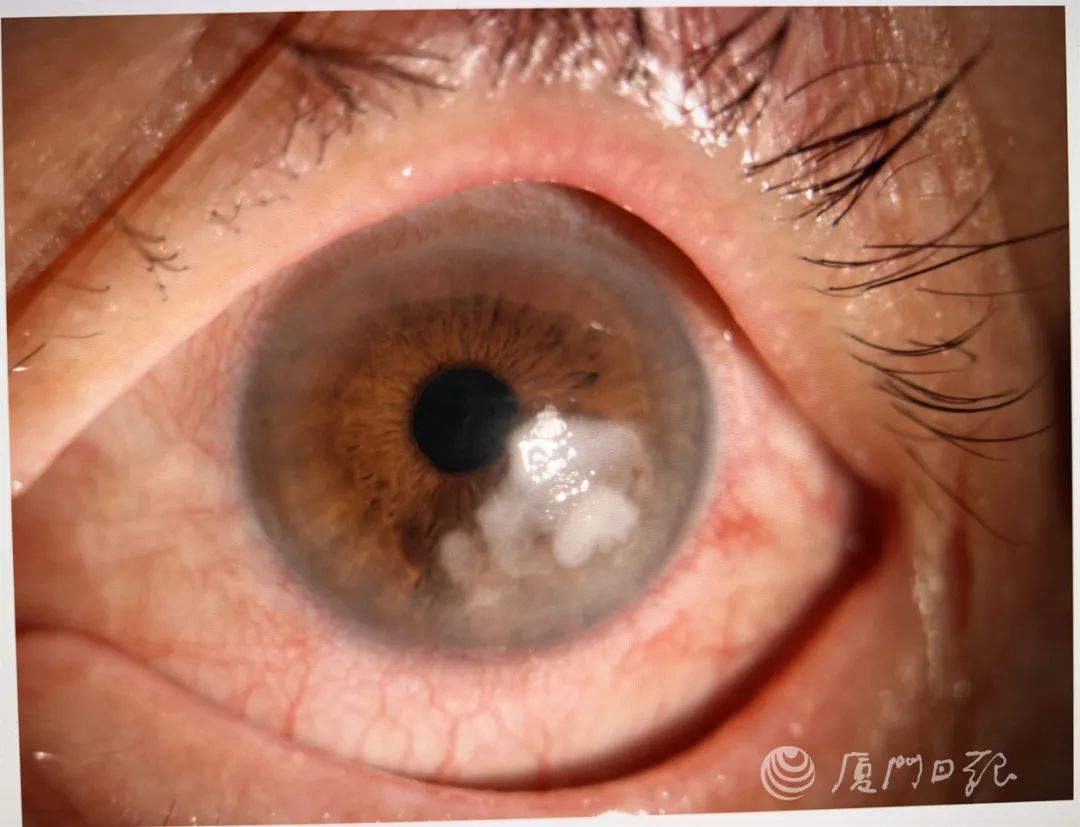 眼角膜在哪一层 9b47-194701319ee0a46b098b2285b8e1b40b.jpg