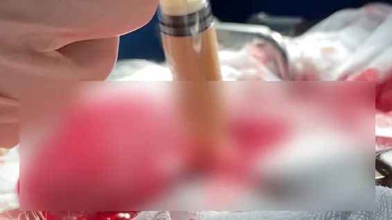 《光环》里逆天的止血道具,真的被搬到现实了